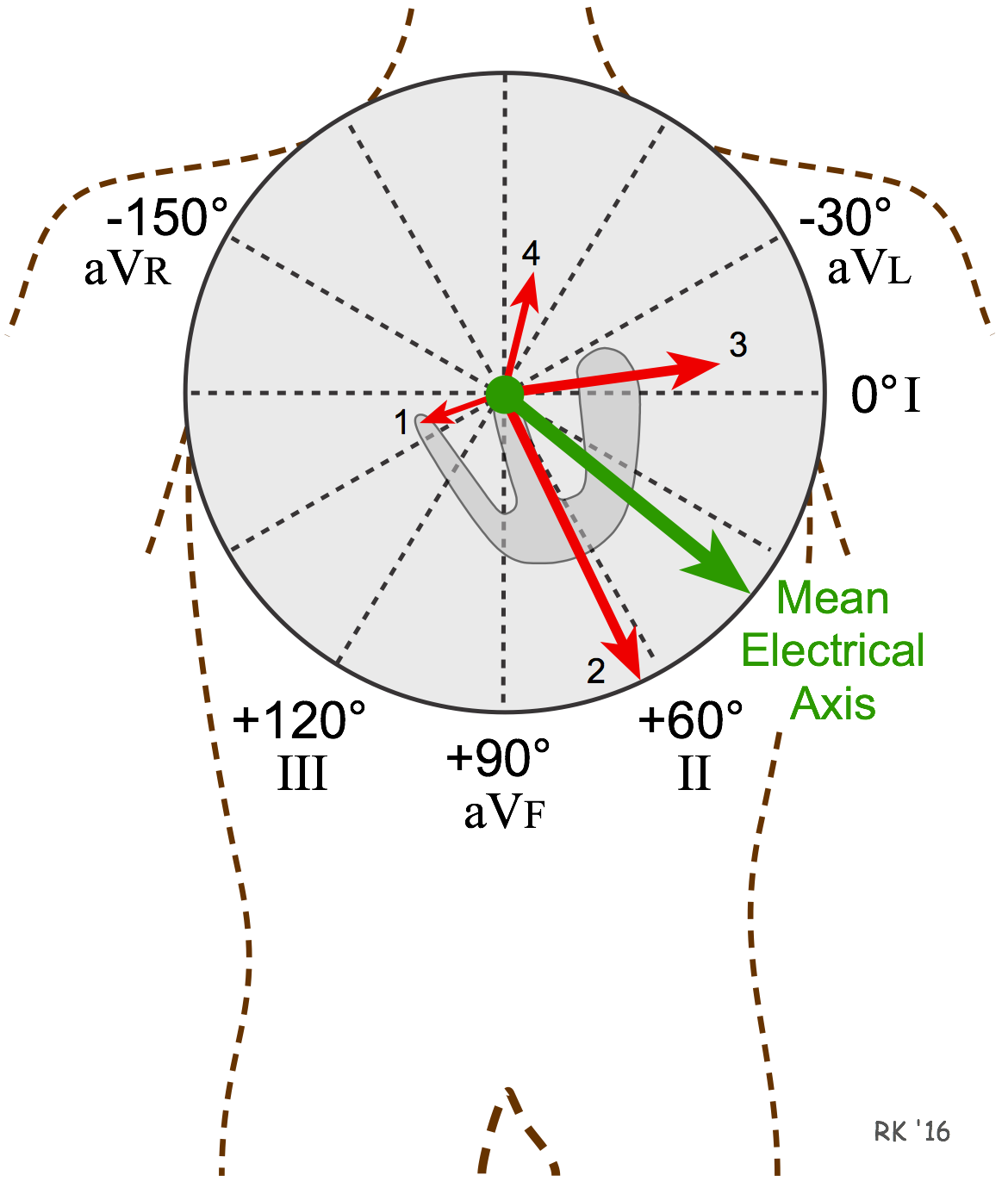ECG electrical mean axis